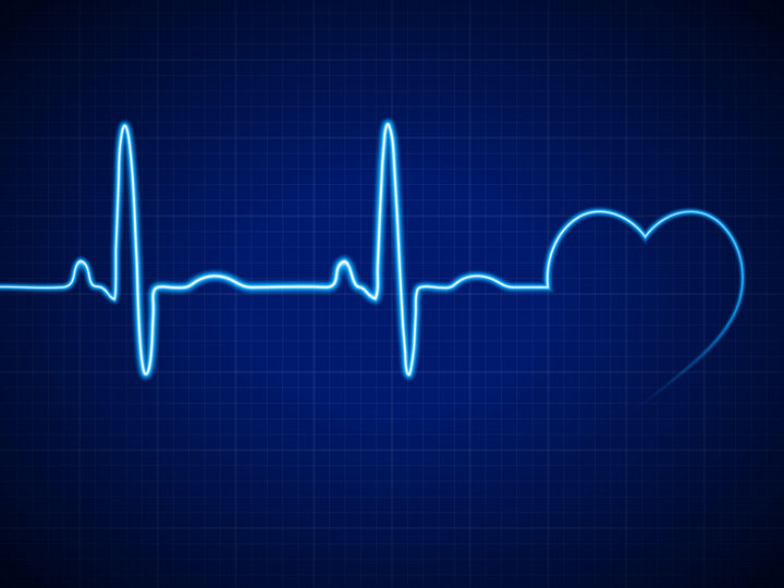 Ilustracija srčanog ritma EKG