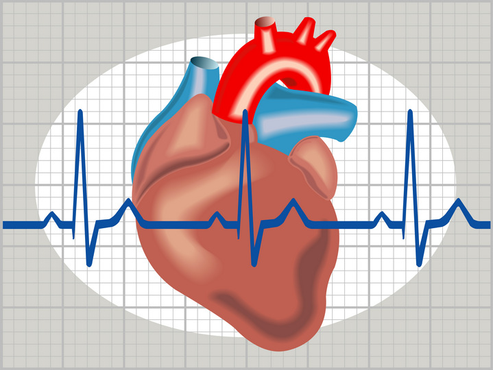 srčana aritmija