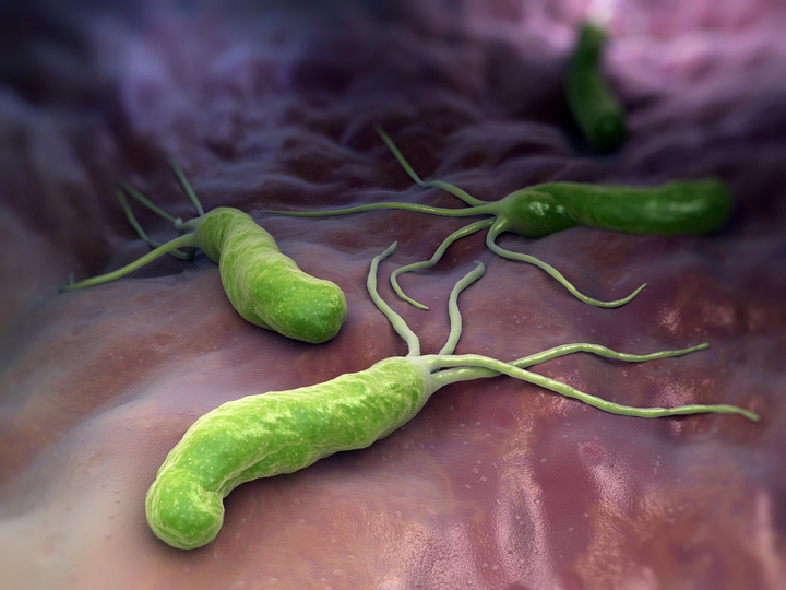 Helicobacter Pylori heliko bakterija